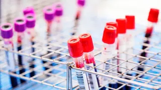 San Francisco Reports 4.3% Increase in New HIV Cases, Raising Concerns Among LGBTQ+ Advocates